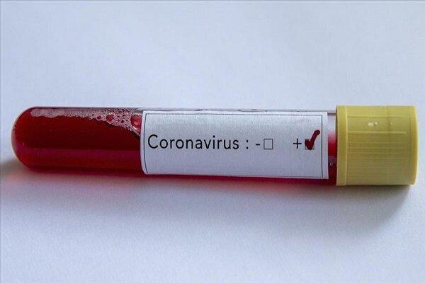 یک شرکت ژاپنی اعلام کرد؛ درمان ویروس کرونا با پلاسمای خون افراد بهبود یافته